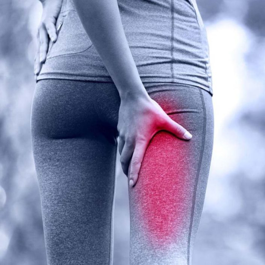 Sciatica Pain